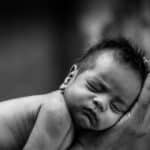 syndrome du bébé secoué